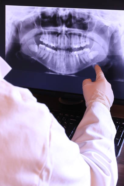 Best Emergency Dentist for Lost Fillings or Crowns in Oakfield, WI