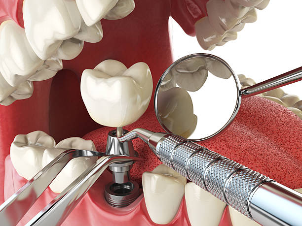 Best Emergency Dental Extractions in Oakfield, WI